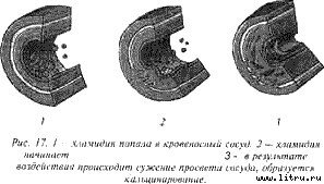 Очищение организма и здоровье - i17.jpg